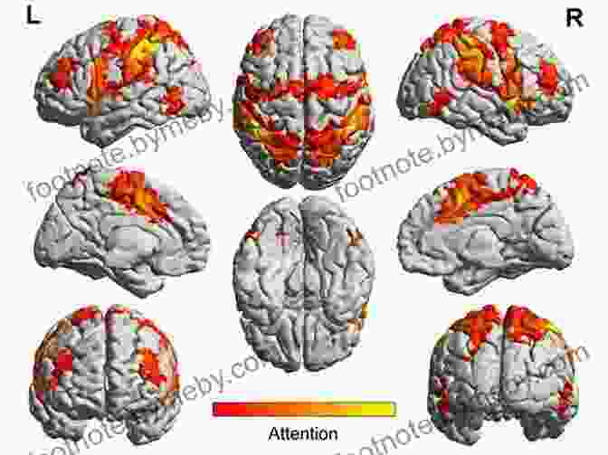 Brain Scan Showing How Music Activates Different Regions Of The Brain Music That You Need To Know Before You Die: 1960s